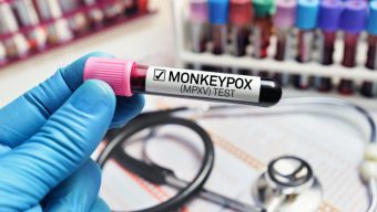 Un premier cas de variole du singe confirmé dans les Pays de la Loire